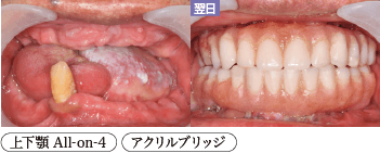 患者様症例1