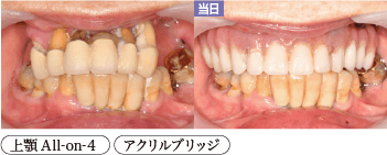 患者様症例2