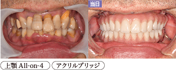 患者様症例3