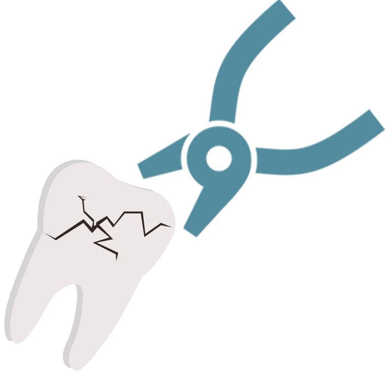 抜歯のアイコン。ナルト先生を中心に安心の歯科医療を提供。オールオン4ザイゴマクリニック。