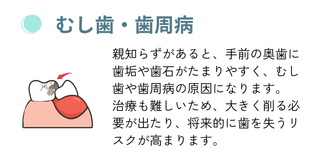 親知らずの影響。ナルト先生を中心に安心の歯科医療を提供。オールオン4ザイゴマクリニック。