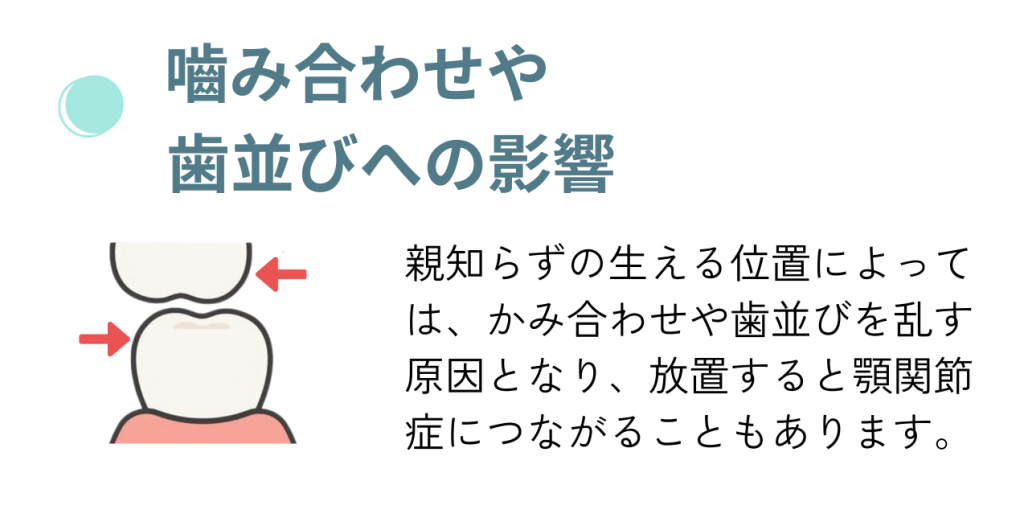 親知らずの影響。ナルト先生を中心に安心の歯科医療を提供。オールオン4ザイゴマクリニック。