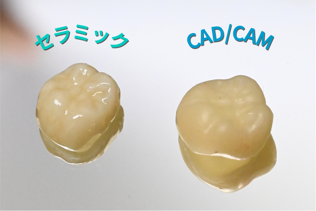 セラミックとCAD/CAM比較写真。ナルト先生を中心に安心の歯科医療を提供。オールオン4ザイゴマクリニック。