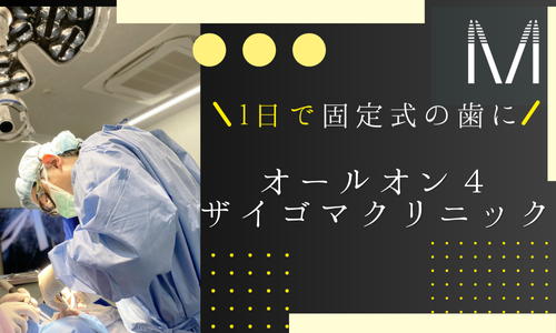 オールオン４ザイゴマクリニック